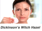Dickensons